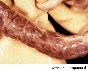 Intestino colapsado por el elevado número de individuos de Ascaris lumbricoides que contiene