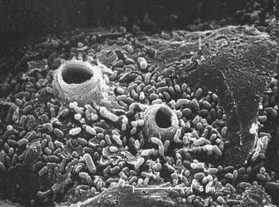 Tubos de descarga de hongos quitridios perforando la piel de un ejemplar moribundo de sapo corredor (Bufo calamita)